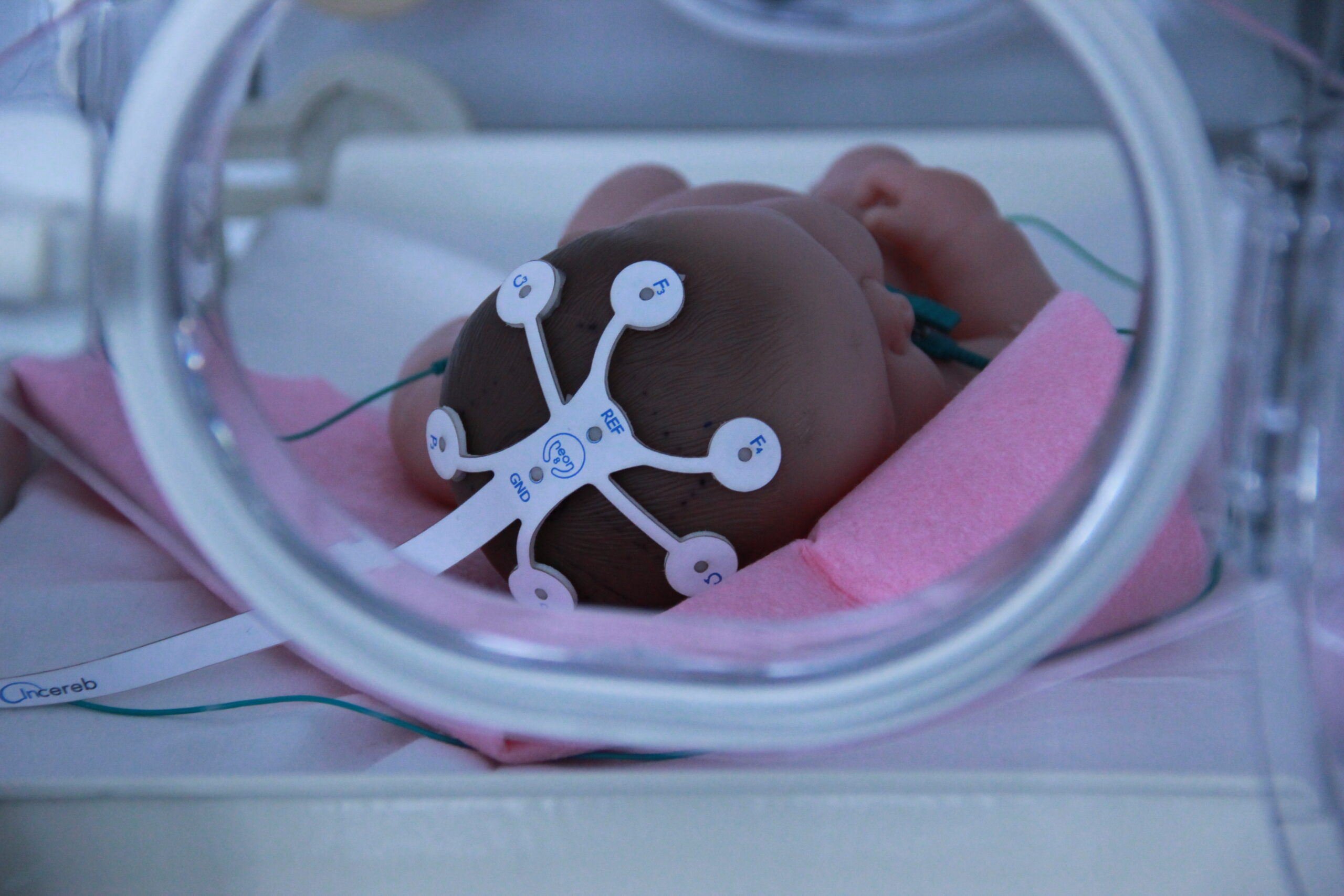 A high-quality label on a baby's head in an incubator.